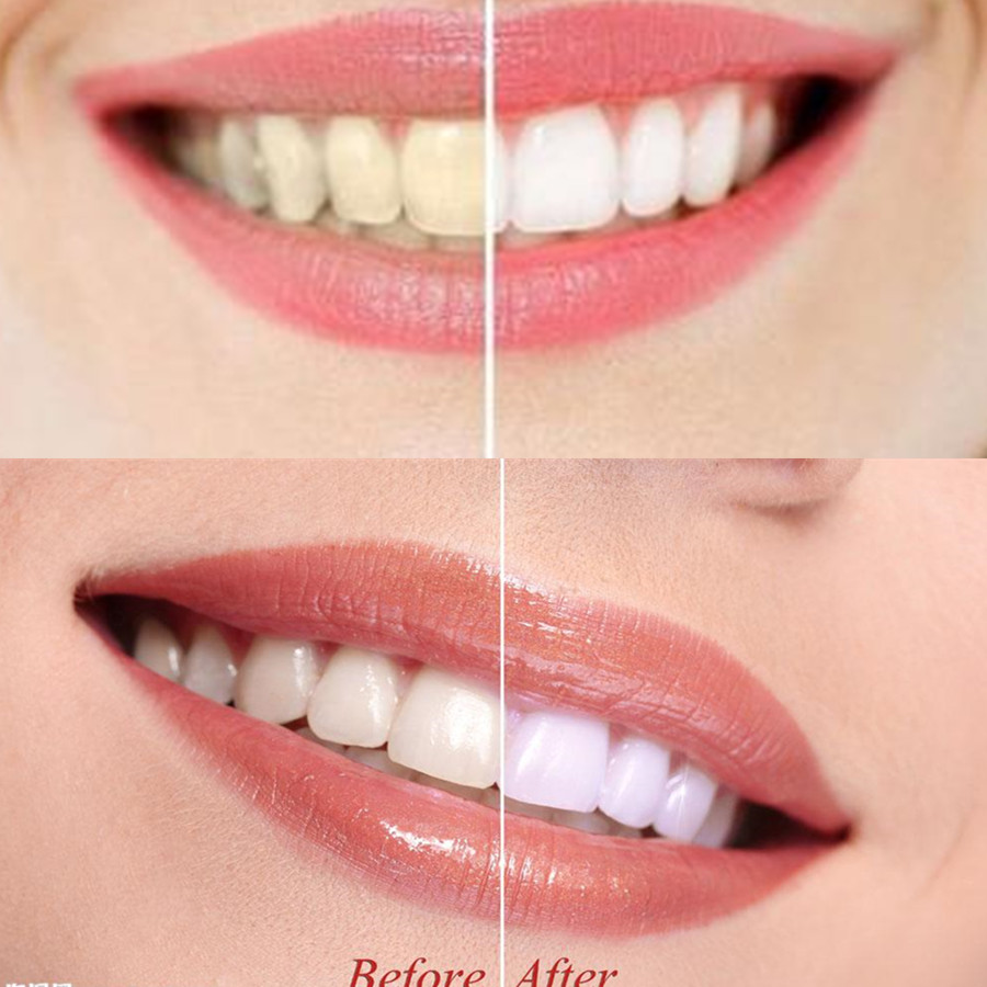 الخيزران الفحم الأسنان الأسنان - مراجعة Teeth Whitening Charcoal وسعره