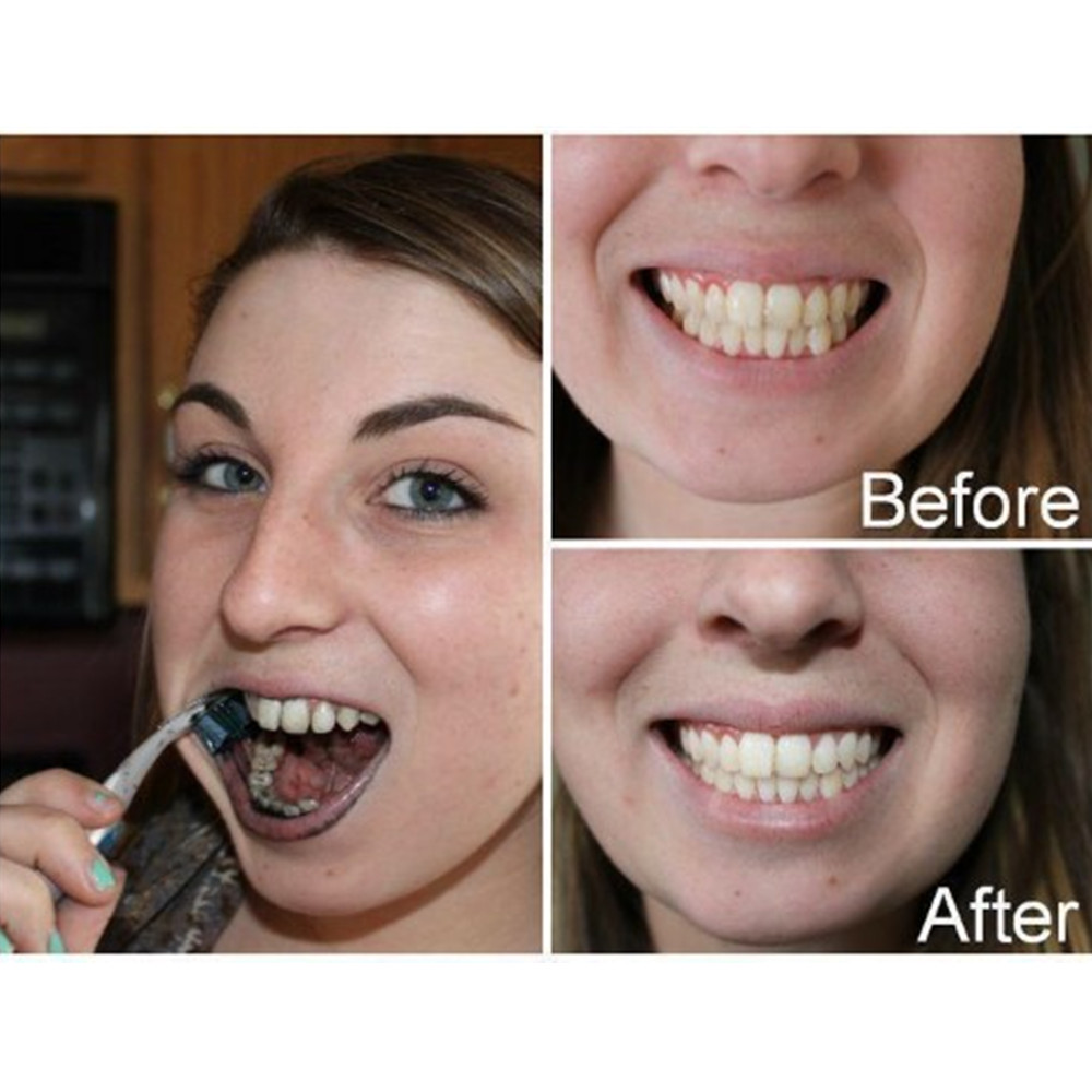 الخيزران الفحم الأسنان الأسنان - مراجعة Teeth Whitening Charcoal وسعره