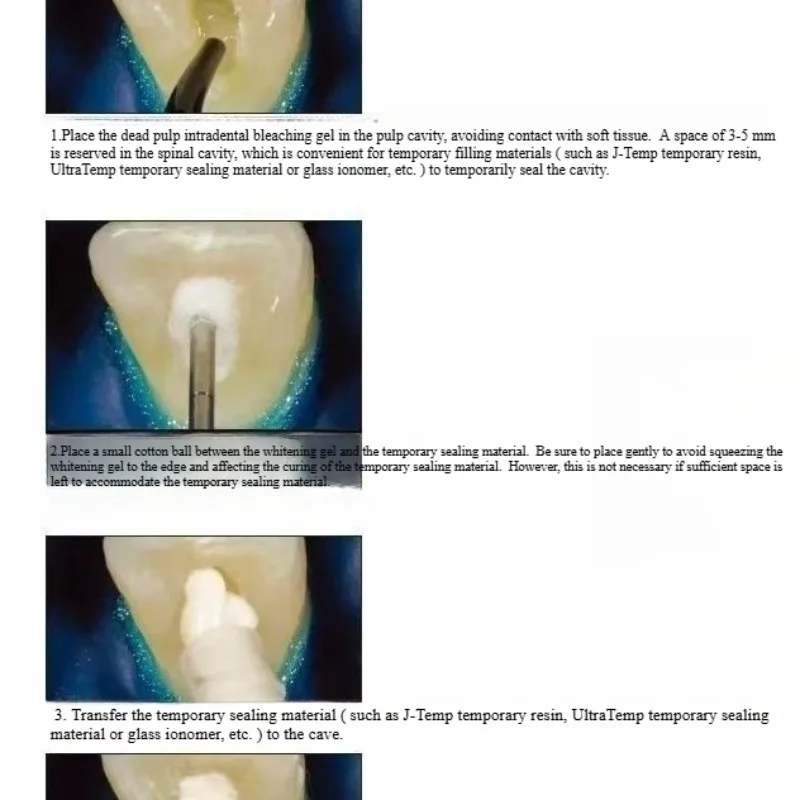 مواد ترميم الفم للأسنان، وكلاء - مراجعة Teeth Whitening Effects وسعره