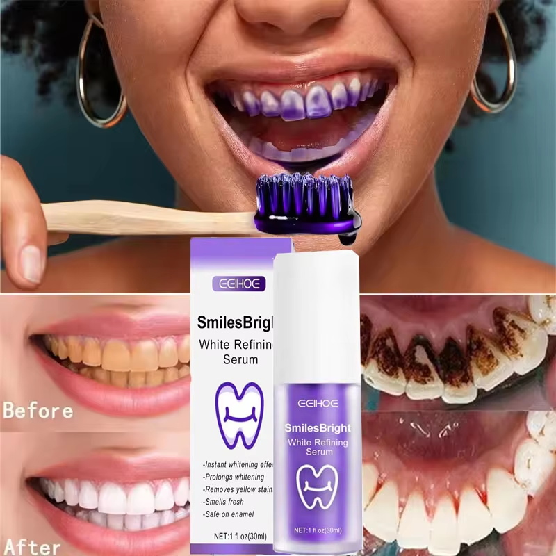 معجون أسنان لتبييض وتنظيف الأس - مراجعة Teeth Whitening Korea وسعره