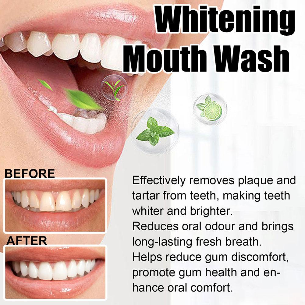 غسول فم بزيت جوز الهند والنعنا - مراجعة Teeth Whitening Oil Pulling وسعره
