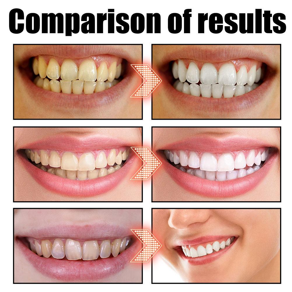 غسول فم بزيت جوز الهند والنعنا - مراجعة Teeth Whitening Oil Pulling وسعره