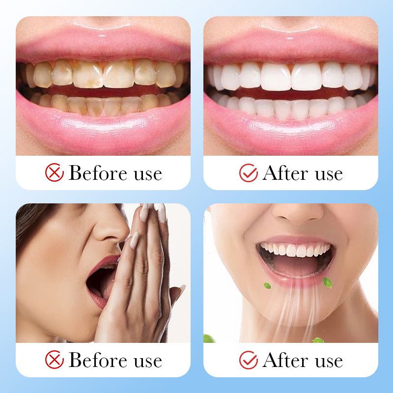 فحم الخيزران الفحم المنشط تبيي - مراجعة Teeth Whitening Charcoal وسعره