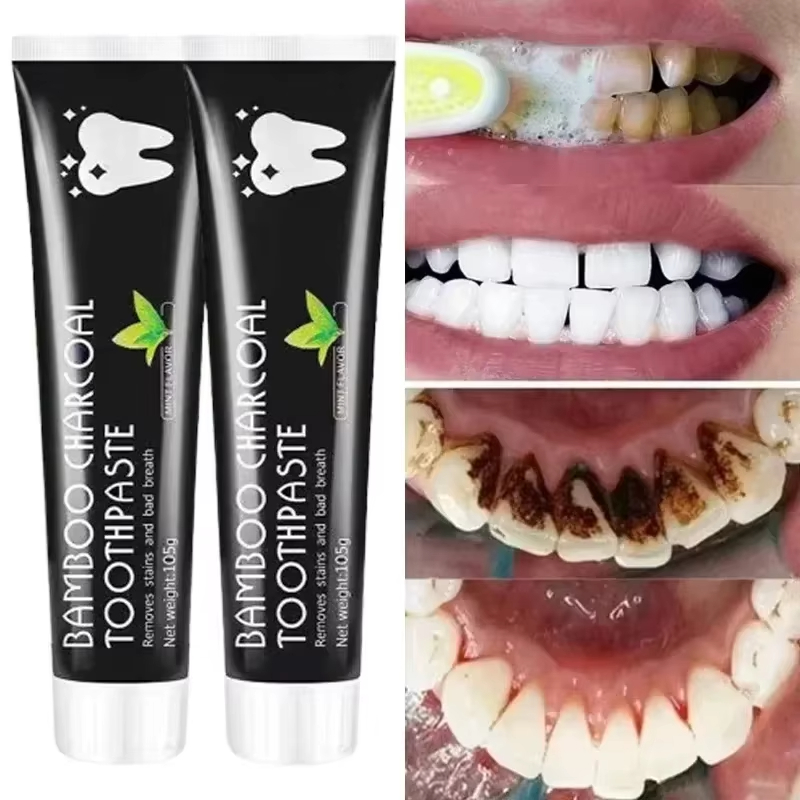 معجون أسنان مبيض معجون أسنان م - مراجعة Teeth Whitening Charcoal وسعره