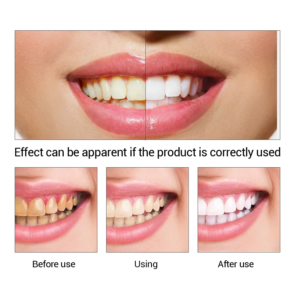 Fteenly تبييض الأسنان جوهر مسح - مراجعة Teeth Whitening Co وسعره