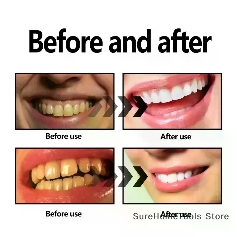 مسحوق الفحم النباتي لتبييض الأ - مراجعة Teeth Whitening Charcoal وسعره