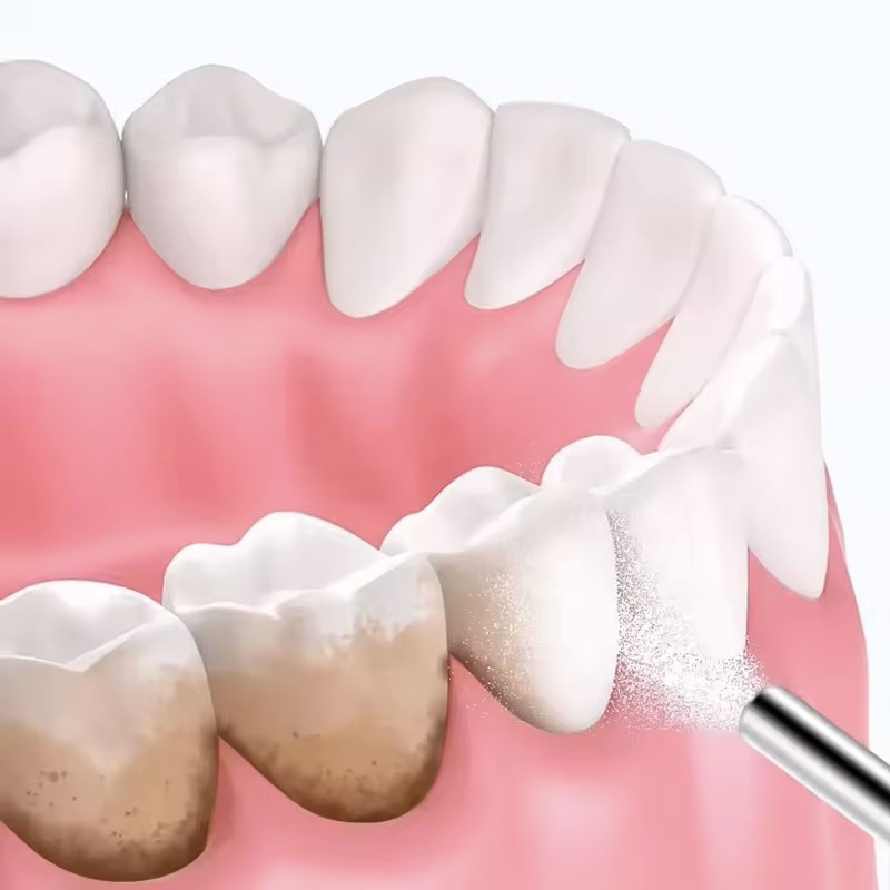 مسحوق تبييض الأسنان بالرمل 130 - مراجعة Teeth Whitening Co وسعره