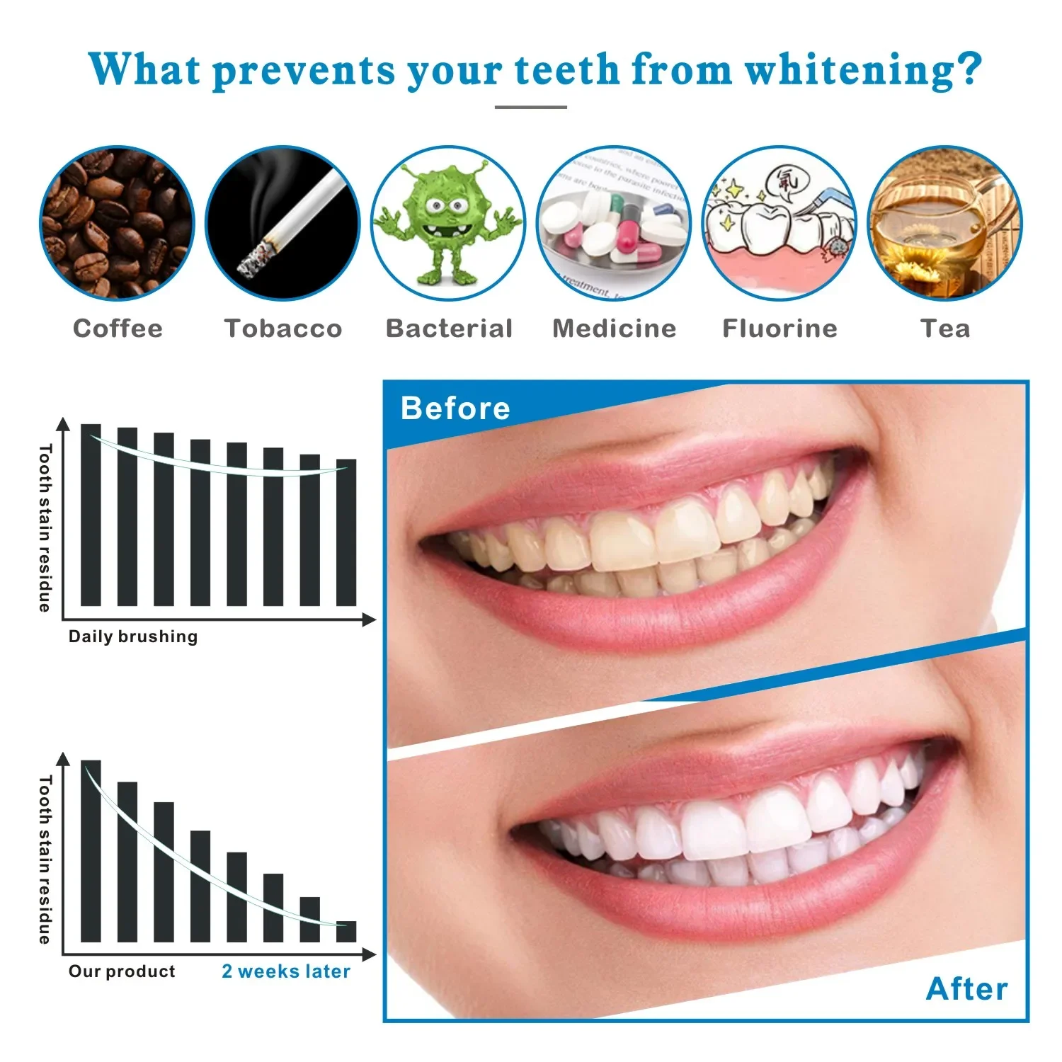 14/28 قطعة شرائط تبييض الأسنان - مراجعة Teeth Whitening Effects وسعره