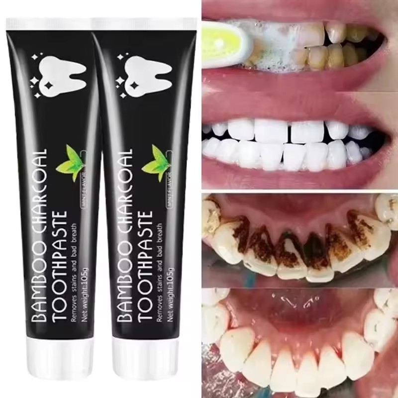 معجون أسنان مبيض بالفحم النبات - مراجعة Teeth Whitening Charcoal وسعره