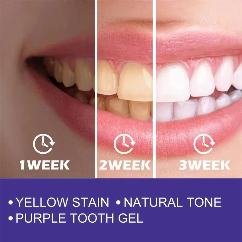 معجون أسنان مبيض لتنظيف الأسنا - مراجعة Teeth Whitening Korea وسعره